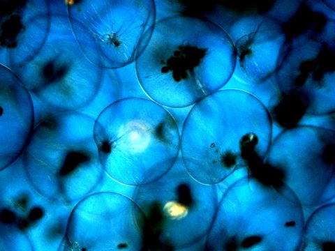 Microscopische opname van zeevonk