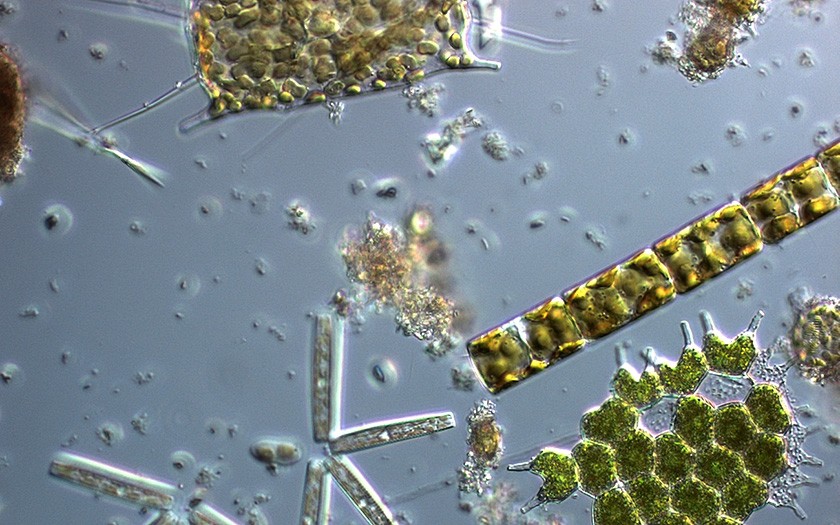 Kiezelwieren door de microscoop gefotografeerd. Foto Jolanda Ipenburg, NIOZ