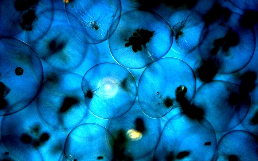 Meeresleuchttierchen unter dem Mikroskop 