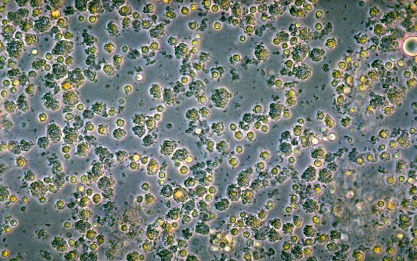 Microscope shot of foam algae